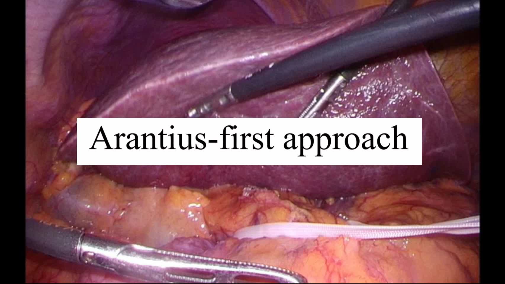 動画2. Arantius-first approach