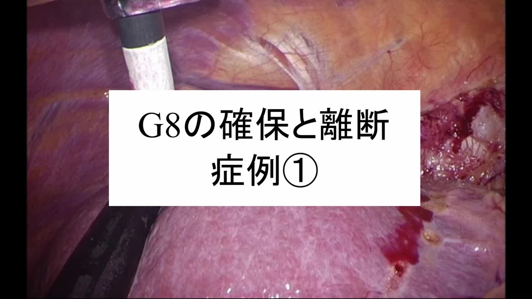 動画3. G8の確保と離断